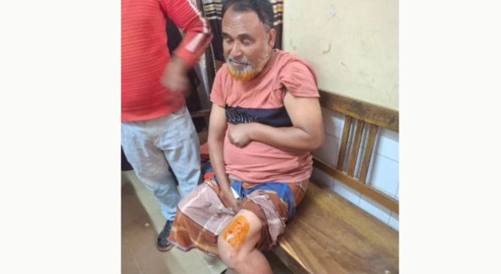 ব্রাহ্মণবাড়িয়ায় কুকুরের কামড়ে আহত ৫